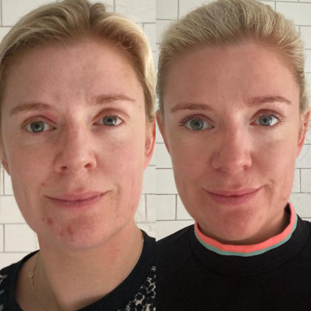 Joanne's Story