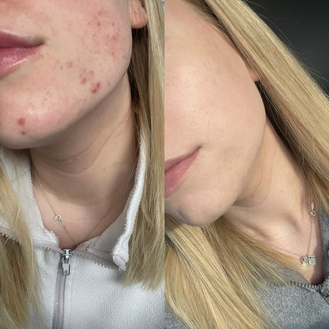 Melissa's Story