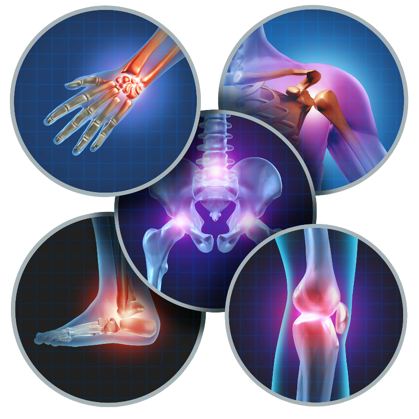 Got painful joints? Take Kollo