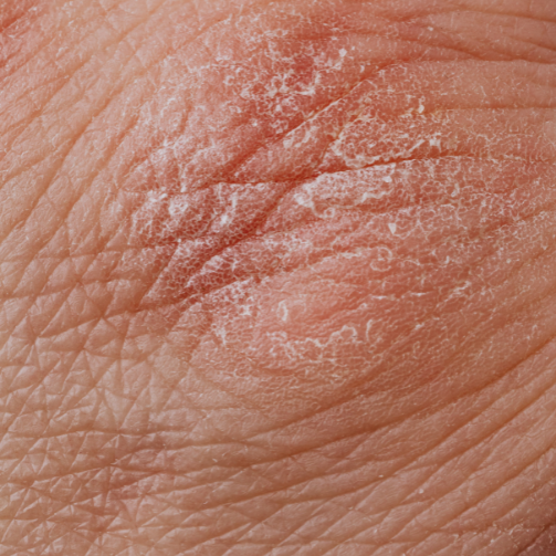 3 conditions you didn't know collagen could treat