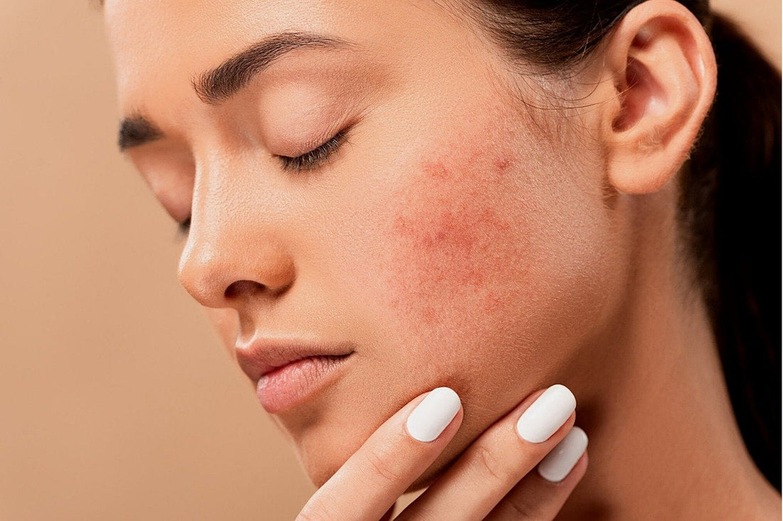 What are the health and beauty benefits of marine collagen?